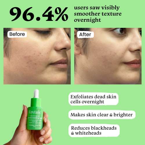 Foxtale: AHA BHA Exfoliating Serum Glycolic Acid + Salicylic Acid Niacinamide   30ml Foxtale: AHA BHA Exfoliating Serum Glycolic Acid + Salicylic Acid Niacinamide   30ml