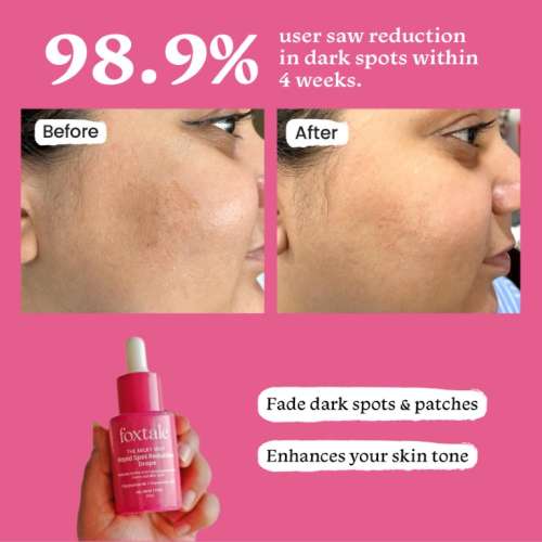 Foxtale: Rapid Spot Reduction Drops With 3% Tranexamic Acid & Niacinamide   30ml