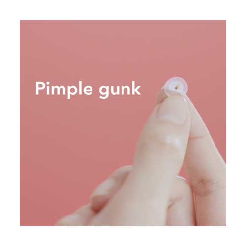 Spot Patch: PM Original 42 Acne Pimple Patches - 42Pcs