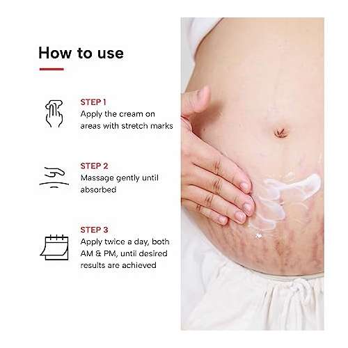 Dermatouch: Bye Bye Stretch Mark Cream - 125gm