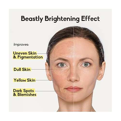 VariHope: 8 Days Brightening Serum With Pure Vitamin C - 15gm