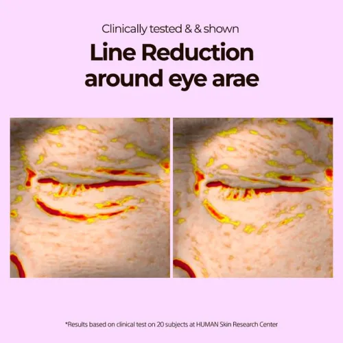 VariHope: Biotics Firming Eye Cream - 20ml