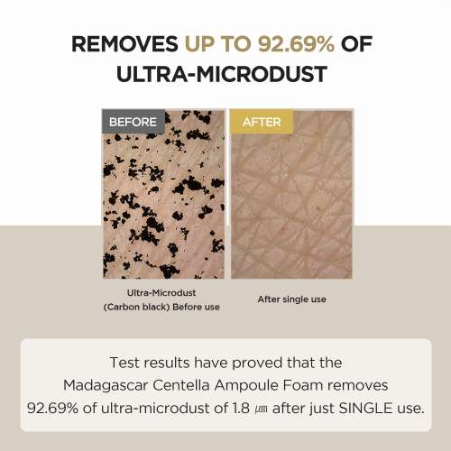 SKIN1004: Madagascar Centella Ampoule Foam  | Calming Care | Sensitive Skin | Face Cleanser | Deep Cleansing | Pore Care | Glow Boost | 125ml