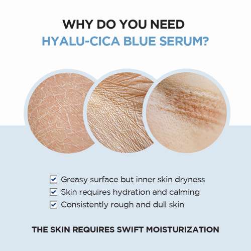 SKIN1004: Madagascar Centella Hyalu-Cica Blue Serum  | Calming Care | Sensitive Skin | Hydrating | Glow Boost | 30ml