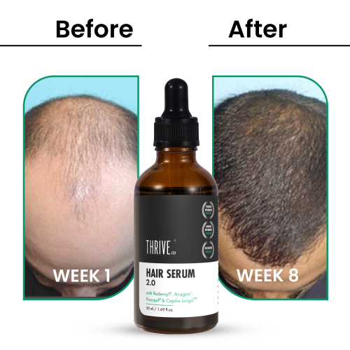 Thriveco: Hair Gowth Serum - 50ml