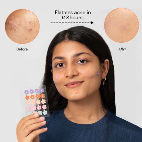 Gush: Dart It Hydrocolloid Pimple Patches- Purple heart