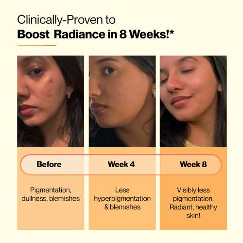 SETU: Skin Renew Glutathione - Orange Flavour -15 Effervescent Tablets