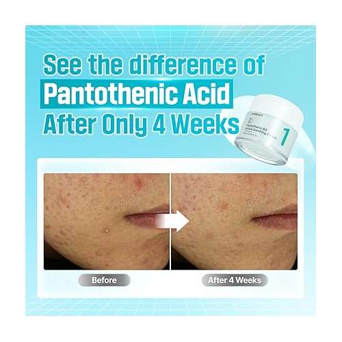 Numbuzin: No.1 Pantothenic B5 Active Soothing Cream (80ml)