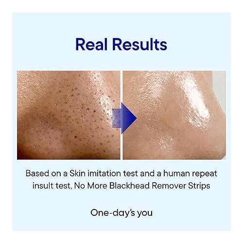 One-Day's You: P.Z. SSOC SSOC No More Blackhead