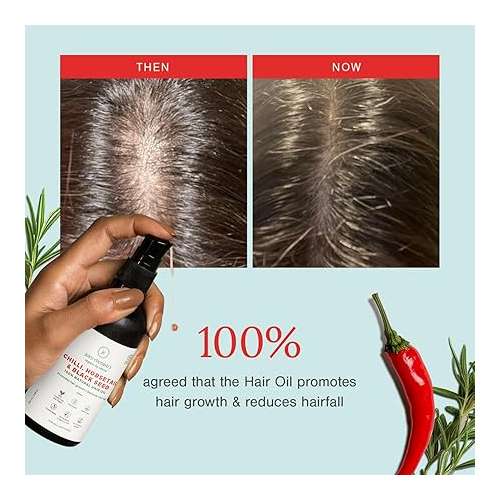 Juicy Chemistry: Chilli, Horsetail & Blackseed Hair Growth Oil, 30 ml | Enriched with Rosemary Oil & Kalonji Oil to Control Hair Fall | Clinically Proven Hair Growth Oil with Natural DHT Blockers for Men & Women | For Healthy Hair, Scalp Nourishment & Hair Regrowth | Der