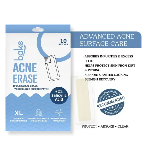 Bake Cosmetics: 2% Salicylic Acid Hydrocolloid Acne Absorbing Surface Patch XL Pimple Patches for Blackheads Removal ,Pore Cleansing & Reduces Whiteheads -Pack Of 10 Strips