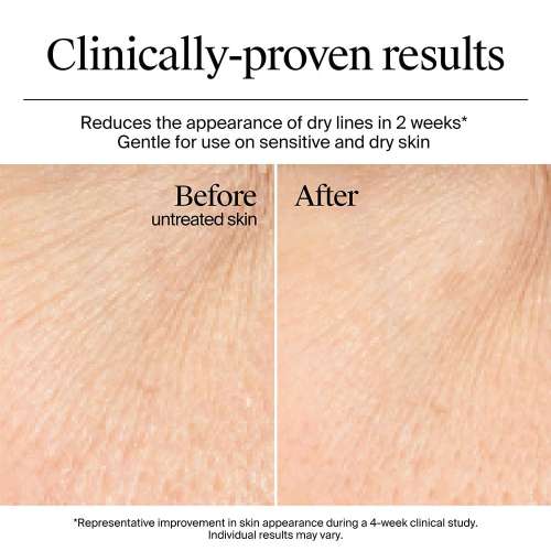 Neutrogena: Hydro Boost Hyaluronic Acid Nourishing Cream 50gm