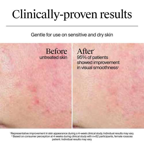 Neutrogena: Hydro Boost Hyaluronic Acid Nourishing Cream 50gm