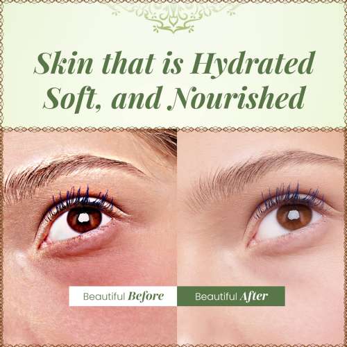 VITMINVEDA: Pure Natural Aloe Vera Gel - 100 gm