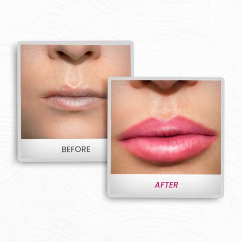 Protouch: Lip Plumping Drops Pouty Pink