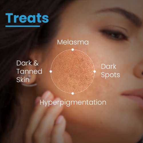 Fixderma Cosmetic Laboratories: AHA Lightening Gel HQ - 15ml