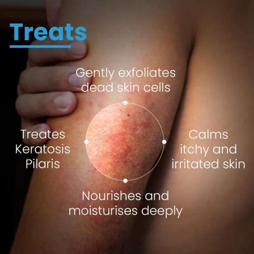 Fixderma Cosmetic Laboratories: Aha Lotion 20 Hydrates Skin And Softens Dryness - 100ml