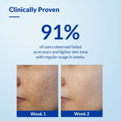 Fixderma: Skarfix -TX Face Cleanser with Tranexamic Acid, Kojic Acid & Niacinamide - 75gm