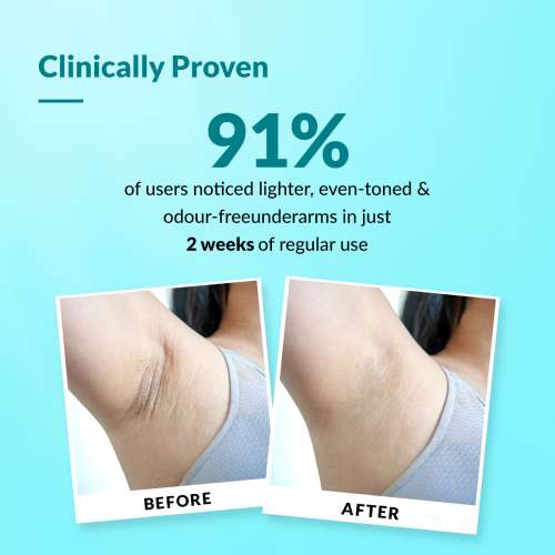 Fixderma: Nigrifix Underarm Roll on with Lactic & Kojic Acid -  60ml