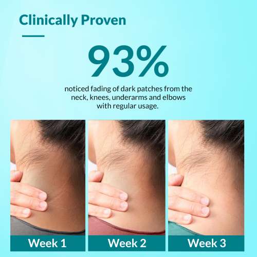 Fixderma: Nigrifix Cream for For Dark Body Parts - 100g