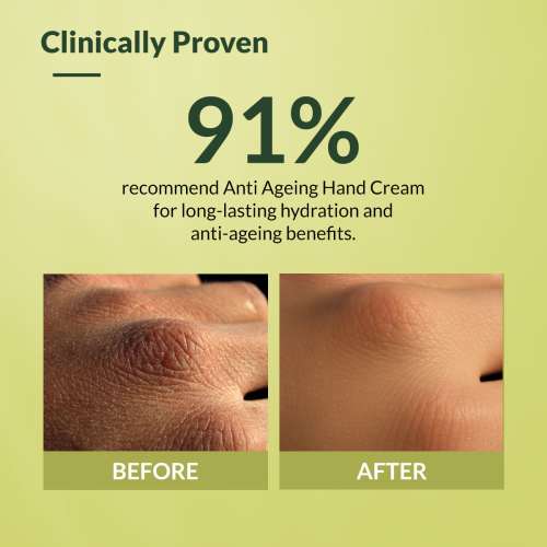 Fixderma: Anti Ageing Hand Cream Dry and Rough Hands  - 30g