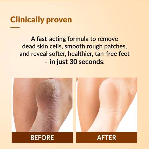 Fixderma: Foobetik Foot Scrub Spray with Lactic Acid 30 sec Scrubber -  50ml