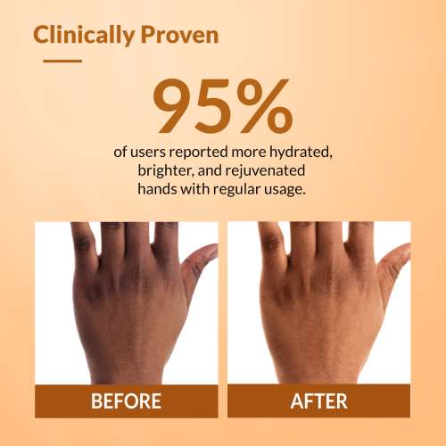 Fixderma: Hand Cream for Dry and Rough Hands  - 30gm