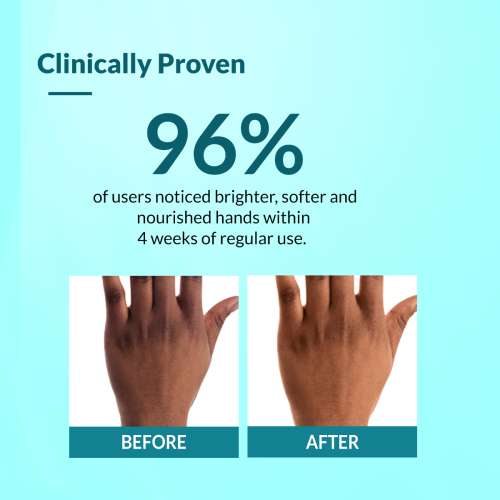 Fixderma: Brightening Hand Cream Kojic Acid Cream - 30gm