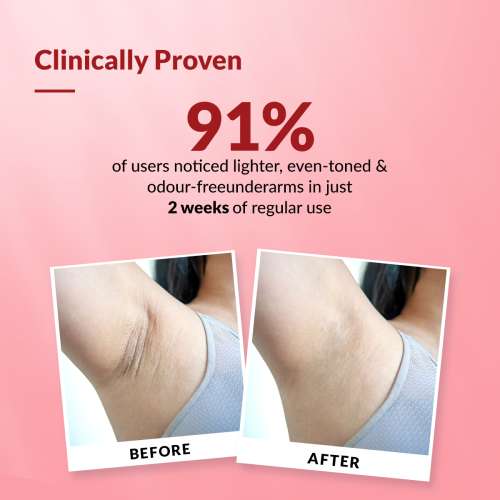 Fixderma: Nigrifix Underarm Velvet Musk Roll On Brightenss Underarm  - 60ml