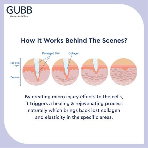 GUBB: Derma Roller Blue