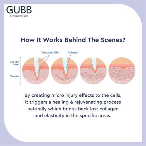 GUBB: Derma Roller Golden