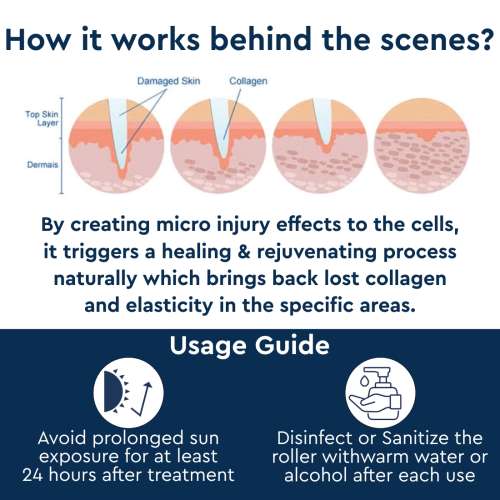 GUBB: Derma Roller (Pink)