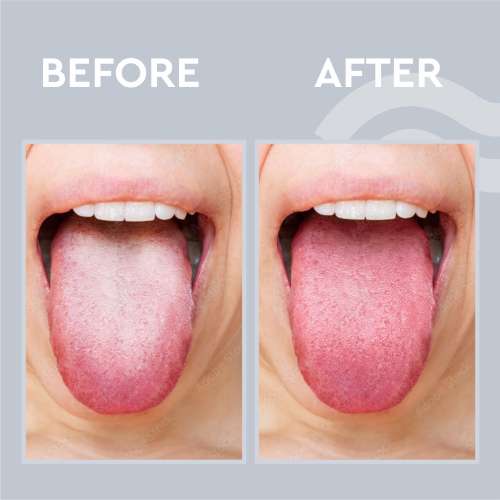 GUBB: Copper Tongue Cleaner Loop