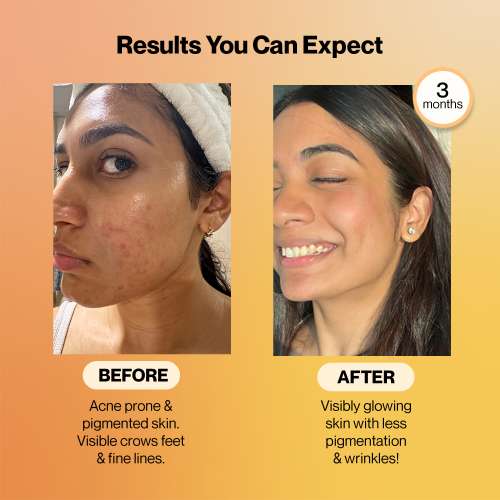 SETU: Radiant Skin Combo- 8g Marine Collagen + Ceramosides- 300gm & 8-in-1 Glutathione Fizzy 30 Tabs, Reduces Hyperpigmentation, Wrinkles, Fine Lines & Supports Supplement, Healthy Skin for Men & Women