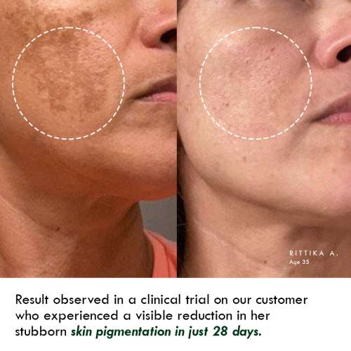 AULI: Retinol 0.3% Face Oil for Anti Ageing - 30ml
