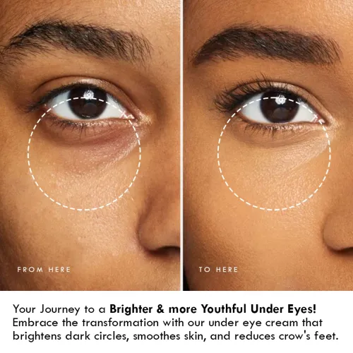 AULI: Eyes and Shine Under Eye Cream - 30 gm