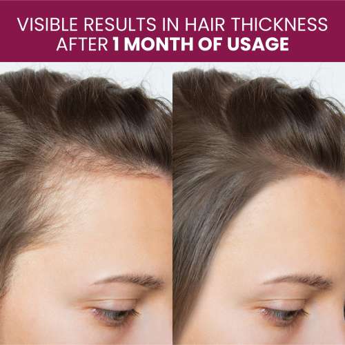 Vlado's Himalayan Organics: Biotin 10000Mcg High Potency For Healthy Hair And Skin - 120 Tablets