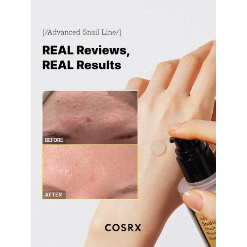 COSRX: Advanced Snail 96 Mucin Power Essence | Intense Hydration | Glass Skin | Snail Mucin | Barrier Repair | 30ml