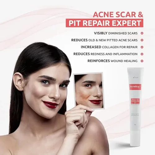 Brinton: Acnescar Gel  15gm