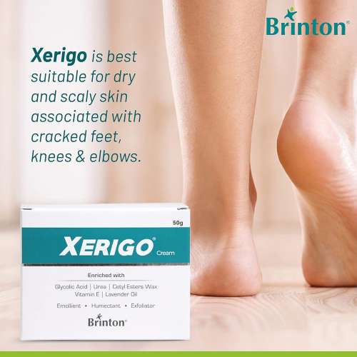 Brinton: Xerigo Cream 50gm