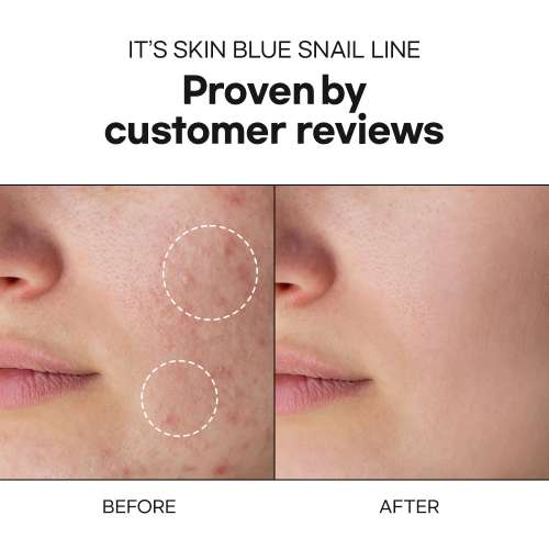 Its Skin: Blue Snail Moisturizer Daily Face Moisturizer  50ml