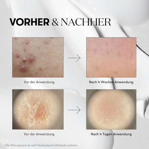 VT Cosmetics: Reedle Shot 300 | Intensive Micro-Needling | Skin Renewal | Anti-Aging | Deep Penetration | 50ml