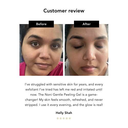 NERAH Skin: Noni Gentle Peeling Gel   50ml