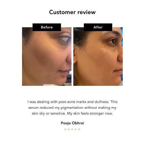 NERAH: Kudzu Restoring Serum   30ml