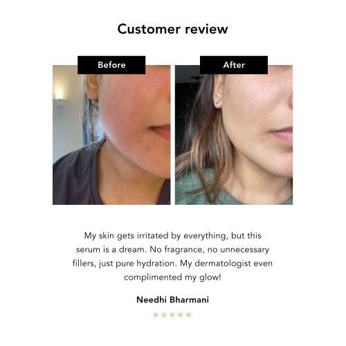 NERAH Skin: Nameko Hydrating Serum  30ml
