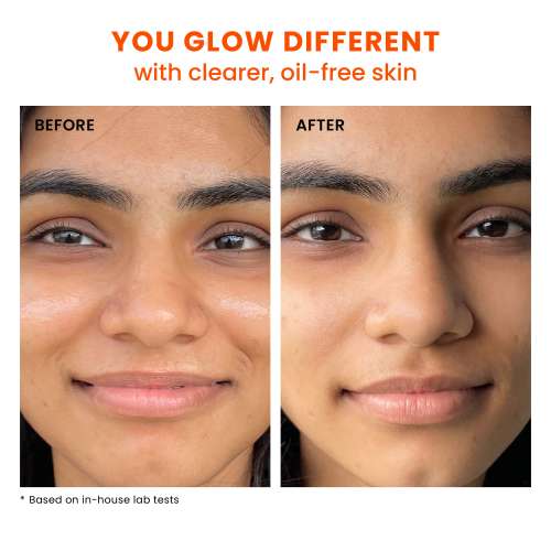 Foxtale: SPF 70 Gel-Cream Sunscreen for Oily Skin with PA++++ & Niacinamide   50ml Foxtale: SPF 70 Gel-Cream Sunscreen for Oily Skin with PA++++ & Niacinamide   50ml