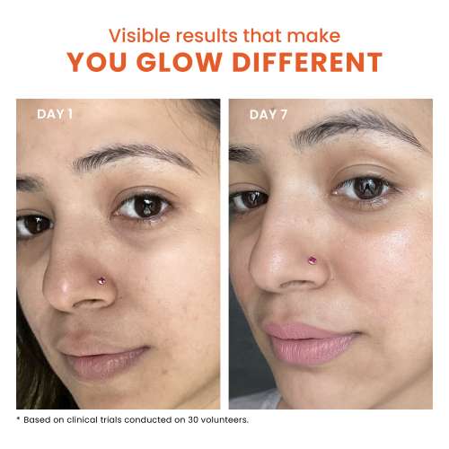 Foxtale: Dewy Sunscreen SPF 70 PA++++ With Niacinamide + Provitamin B5 + Vitamin E   50ml Foxtale: Dewy Sunscreen SPF 70 PA++++ With Niacinamide + Provitamin B5 + Vitamin E   50ml