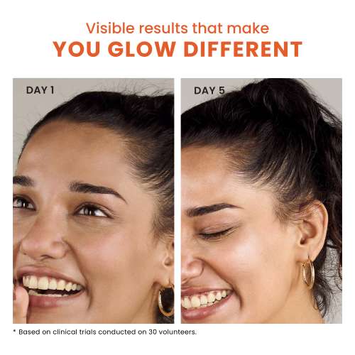 Foxtale: Brightening Vitamin C Face Serum With L-Ascorbic Acid And Vitamin E For Glowing Skin   30ml Foxtale: Brightening Vitamin C Face Serum With L-Ascorbic Acid And Vitamin E For Glowing Skin   30ml