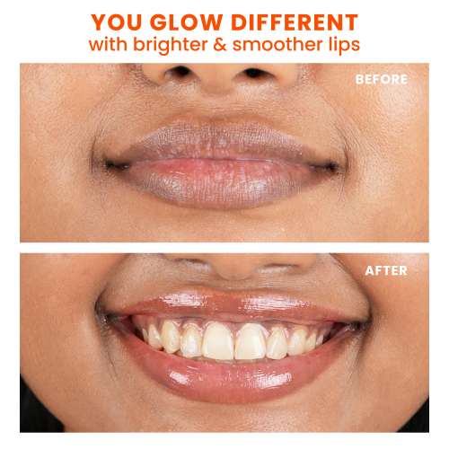 Foxtale: Brightening Lip Balm With Peptides, Vitamin C & Hyaluronic Acid - Clear Glaze  12ml