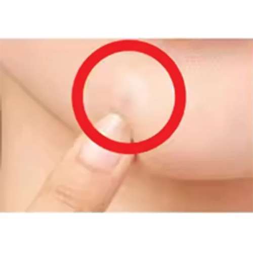 Oz Care: skin patch-3pcs    10gm